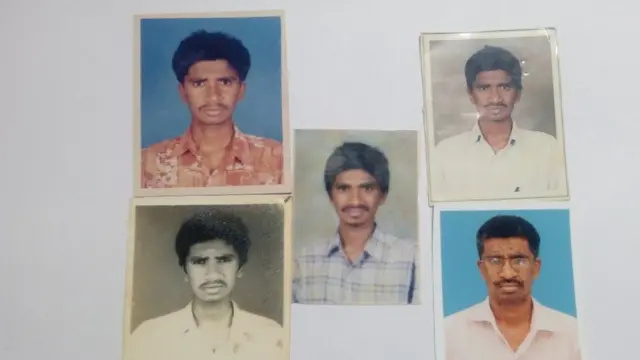 மரபணு குறைபாட்டால் மாறிய முகம்