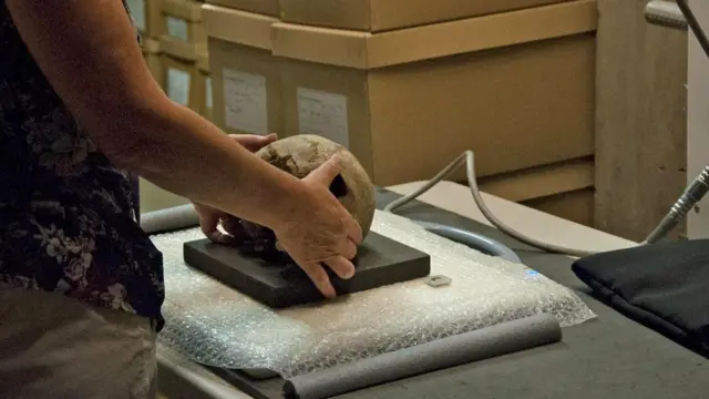 Специалист готовит череп к рентгенографии