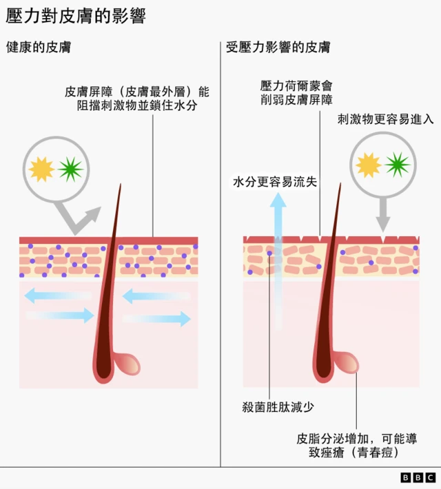 压力对皮肤影响图解