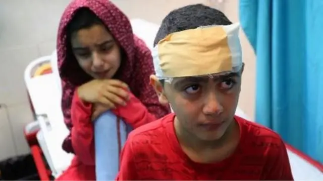 Watot waliopigwa na roketi