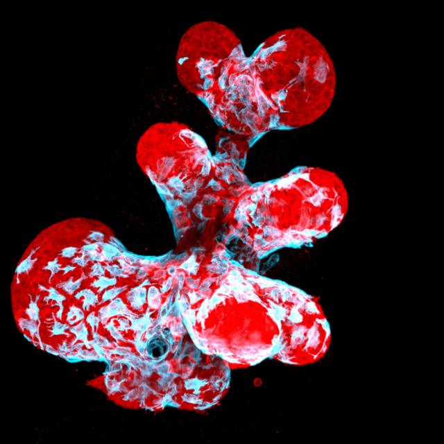 Organoide mamário, que mostra células contráteis mioepiteliais (em azul) e células secretoras (em vermelho)