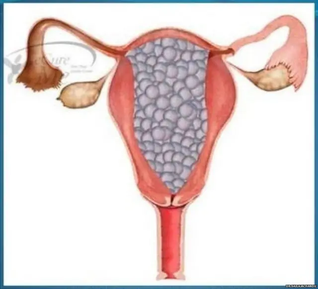 ગર્ભાશય