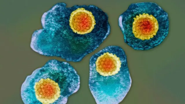 Le virus de l'herpès zoster vu au microscope