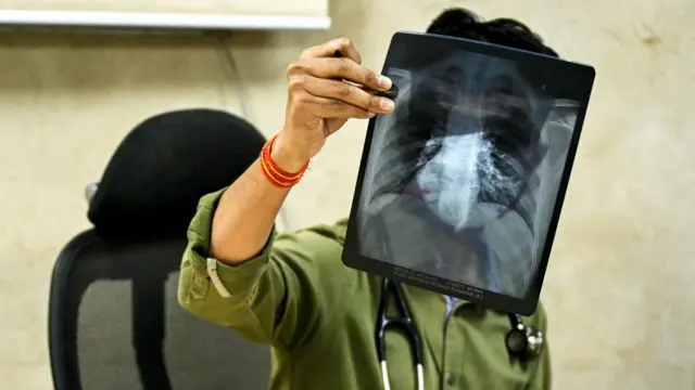 ਸੰਕੇਤਕ ਤਸਵੀਰ