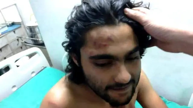 घायल छात्र