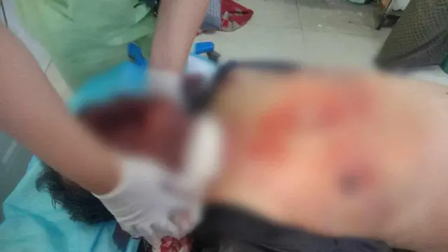 ထိခိုက်ဒဏ်ရာရသူ