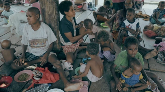 Asmat, gizi buruk, Papua