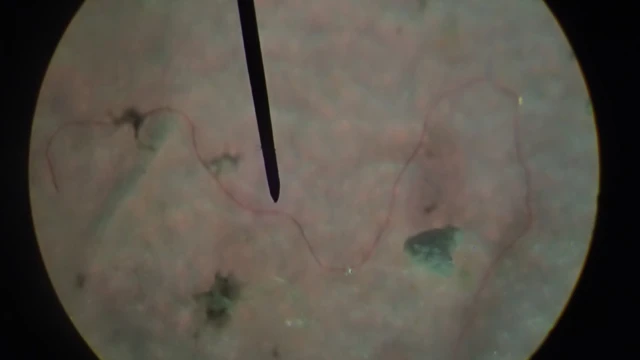 ไมโครพลาสติก