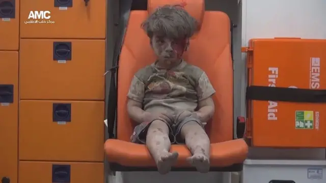 Injured boy covered in dust sitting in an ambulance