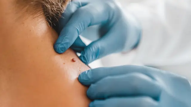 Pinta sendo examinada por médico