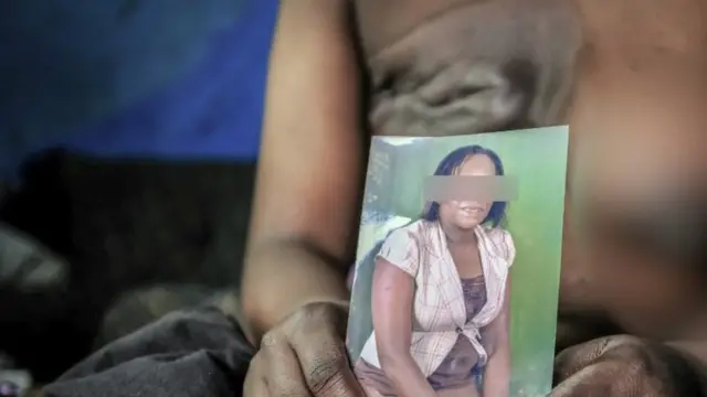 Nwaanyị e bepụrụ otu ara ya maka ọrịa kansa.