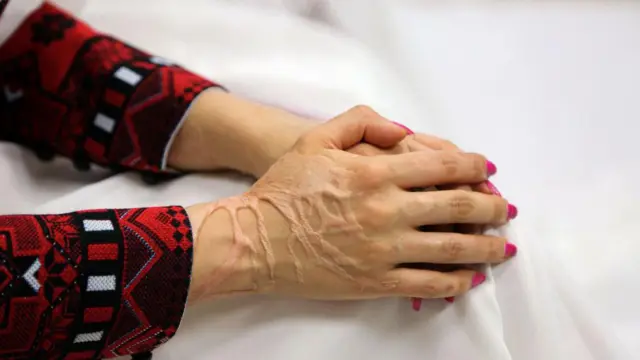 air keras, asam klorida