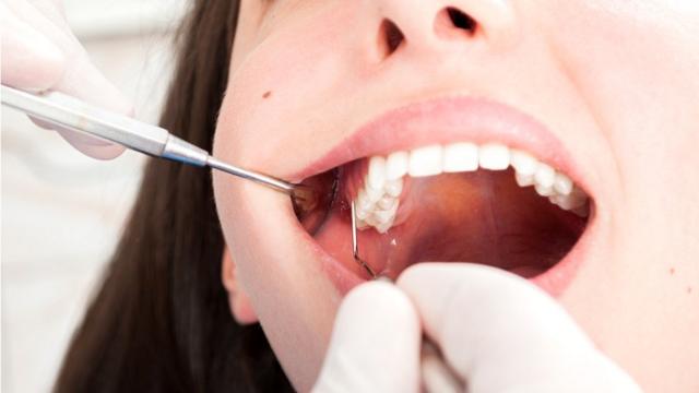 Протезирование при отсутствии трех жевательных зубов с одной стороны