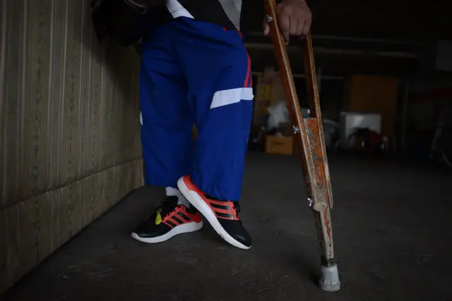 ขาของ ชูชาติ สุขเจริญ นักกีฬายกน้ำหนักคนพิการ สำหรับกีฬายกน้ำหนักคนพิการ มีเกณฑ์ตัดสินผู้ที่จะเข้าแข่งขันได้คือหนึ่งต้องมีลักษณะพิการที่ขา หรือสองมีลักษณะเป็นคนแคระ