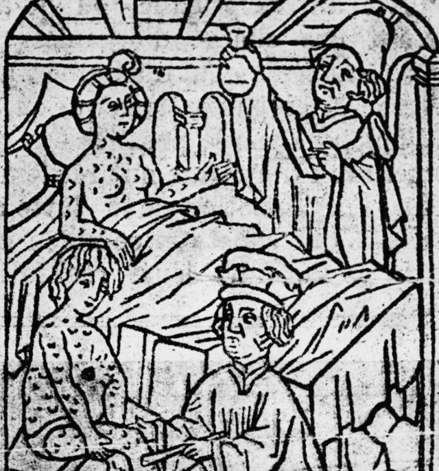 Imagen del siglo XV de médicos tratando a una pareja enferma de sífils.