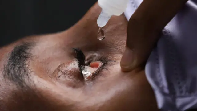 አይን ጠብታ እየተደረገ