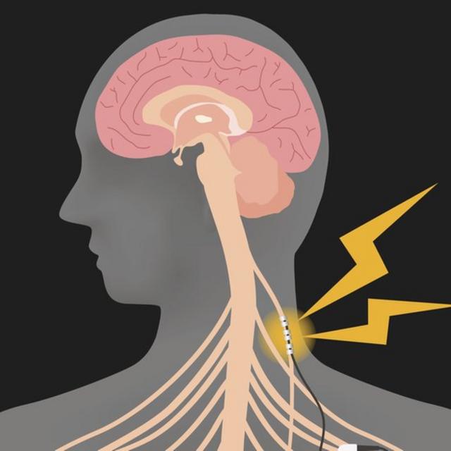 Ilustración del vago enviando señales al cerebro