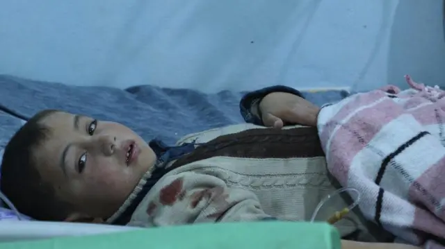 Mtoto akipata matibabu katika hospitali ya SAMS kaskazini mwa Syria