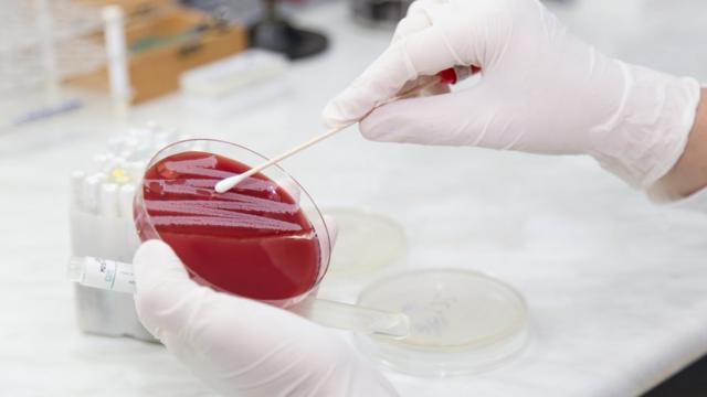 Colôniabragantino e goiás palpitesbactérias