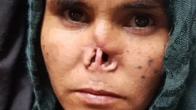 زاركا سعيدة لأن طفلها لم يشاهد ما فعله الأب