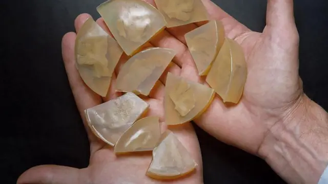 Препарированный мозг великого физика был извлечен из черепа Альберта Эйнштейна патологоанатомом