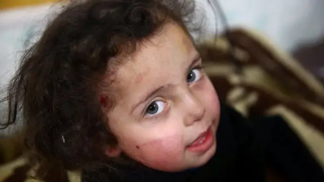 بنا بر گزارش ها، حداقل ۱۲۷ کودک در ظرف یک هفته در غوطه شرقی کشته شده اند