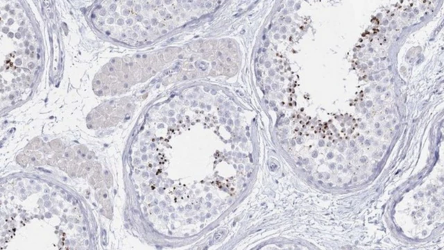 ภาพตัดขวางขยายให้เห็นเนื้อเยื่อภายในอัณฑะซึ่งมีความพิเศษไม่เหมือนอวัยวะใด