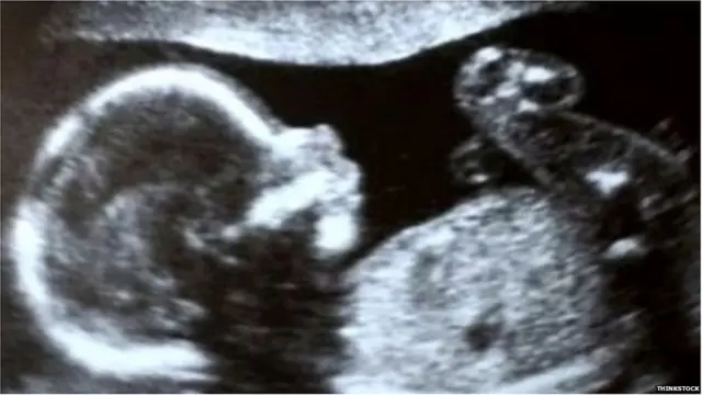 गर्भपात, गर्भधारण, महिलाएं