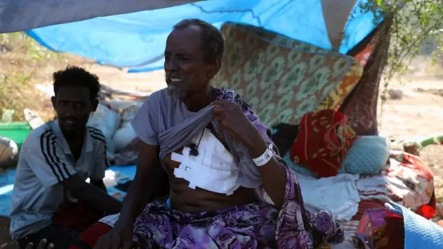 صور من حياة اللاجئين الإثيوبيين في السودان