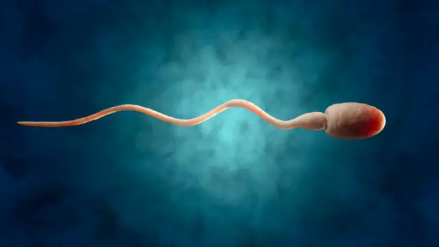 শুক্রাণুর সংখ্যা মিলিলিটারপ্রতি ৪ কোটির কম হলেই অনুর্বরতার সমস্যা শুরু হয়