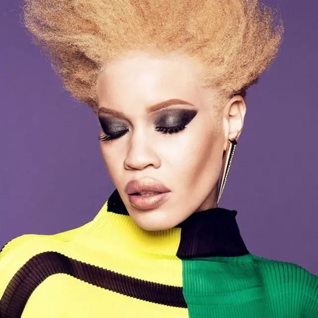 Diandra Forrest est le premier mannequin albinos égérie d'une grande marque de beauté.