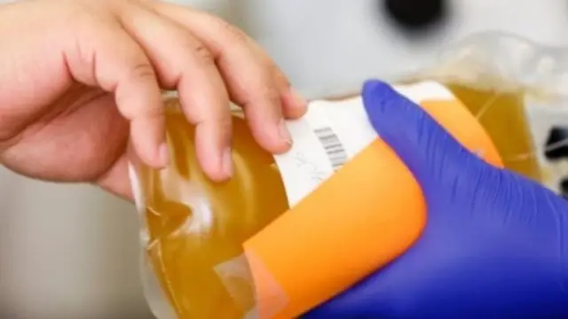 प्लाज़्मा