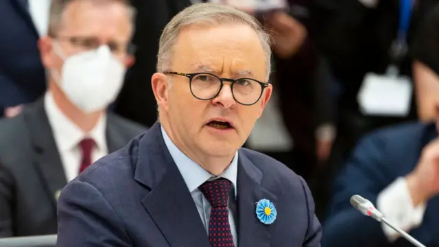 एंथनी अल्बनीज़