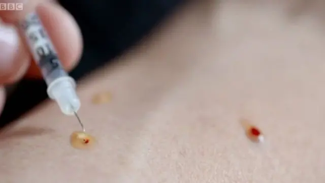 દર્દીને આપવામાં આવતા ઈન્જેક્શનનો ફોટોગ્રાફ