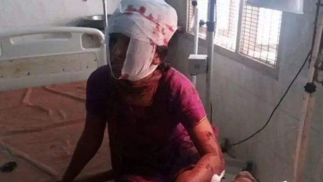 The injured woman in hospital