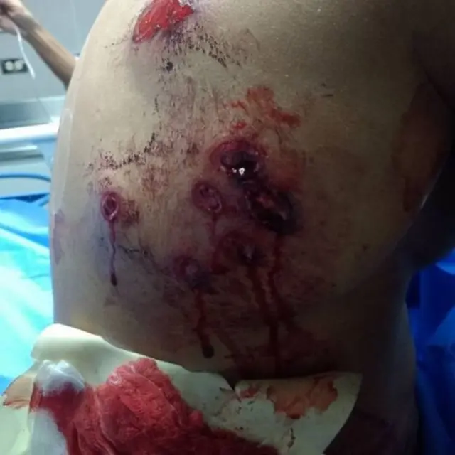 окровавленная нога