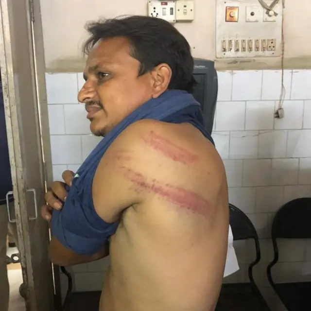 ઇજાગ્રસ્ત વ્યક્તિ