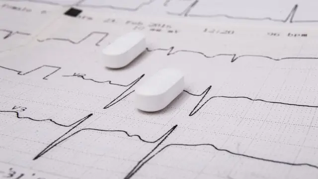 picture of pills on a ECG