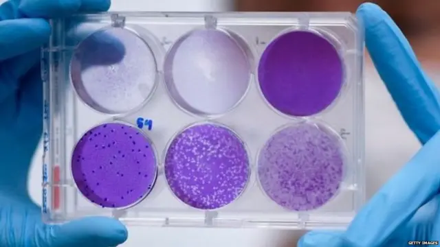 ਕੋਰੋਨਾਵਾਇਰਸ