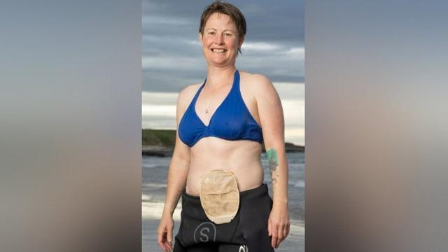 Swimming with my stoma bag - BBC News