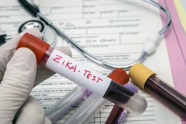 Tubo de laboratorio con sangre