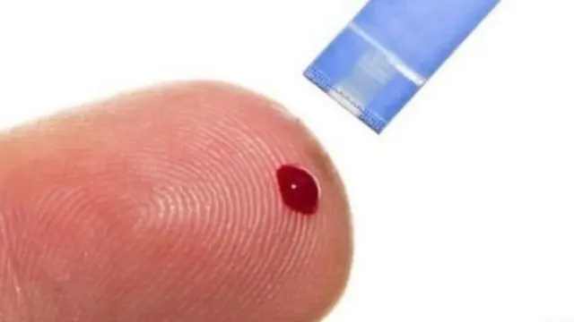 சர்க்கரை நோய் பரிசோதனை