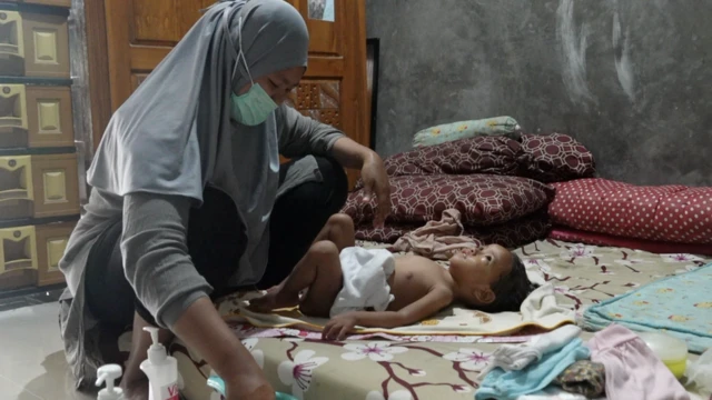 gagal ginjal akut obat sirop