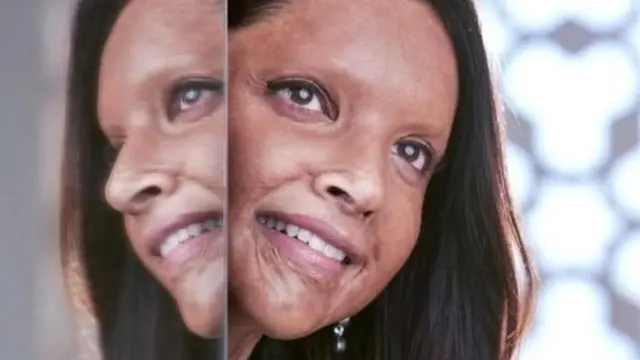 چھپاک میں اداکارہ دیپیکا پادوکون