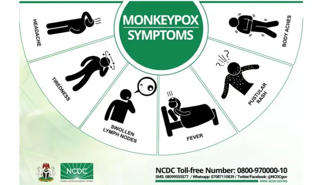 Foto dey show signs wey you go take know say na monkey pox virus