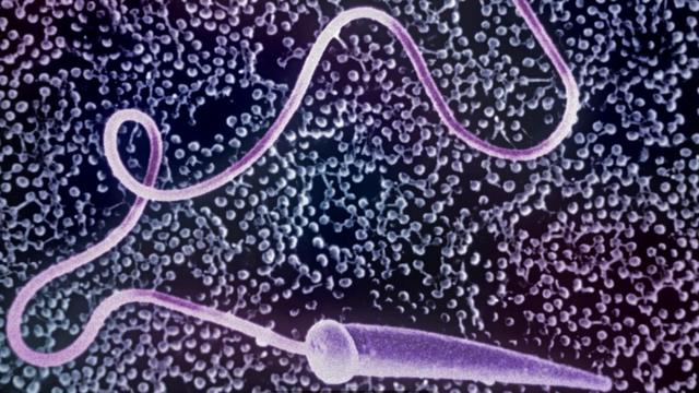Продолжительность жизни сперматозоидов в разных местах