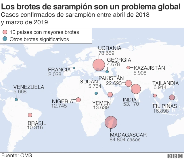 brotes de sarampión