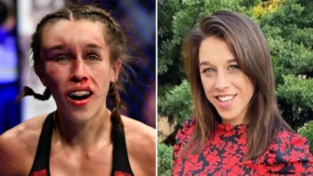 Split picture of Joanna Jedrzejczyk immediately after UFC 248 and when her facial injury had recovered