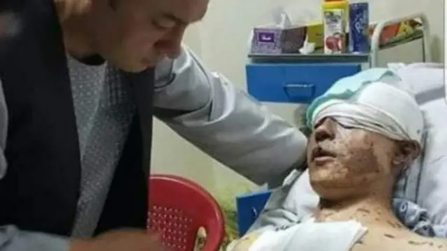 افغانستان جګړه، ولسي وګړي