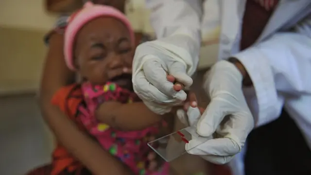 Prueba de sangre por sospecha de malaria.